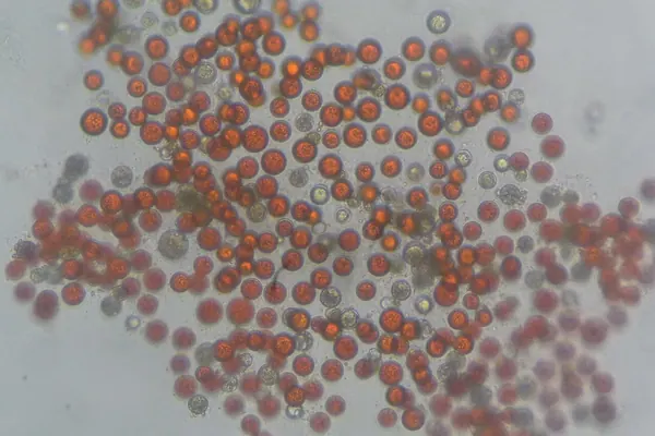 Haematococcus pluvialis microalgae cells with red astaxanthin under a microscope